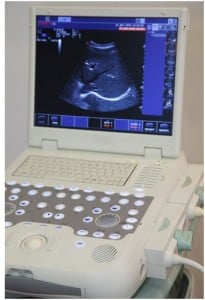 ultrasound 205x300 The new battleground in abortion law: ultrasounds. 