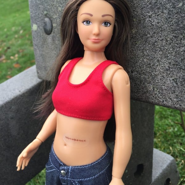 Barbie with stretch marks