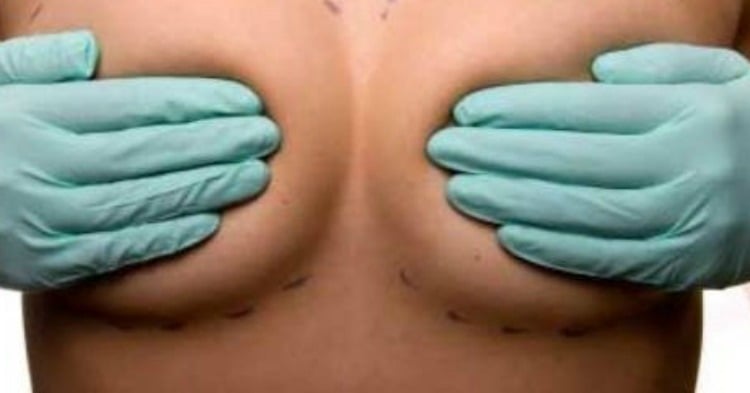 Busting Myths: Breast health facts you need to know.
