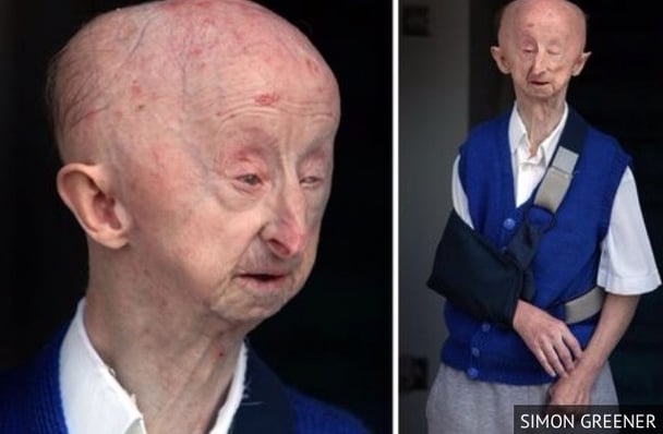 AlanBarnes