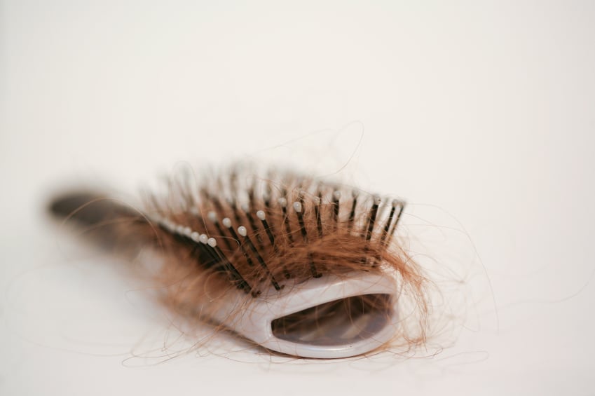 female hair loss