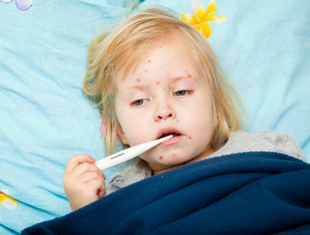 mesles vaccines