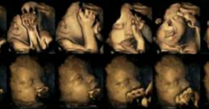Smoking while pregnant