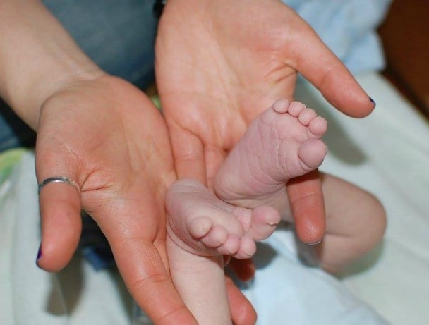 down syndrome baby abandoned