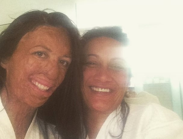turia pitt's new nose