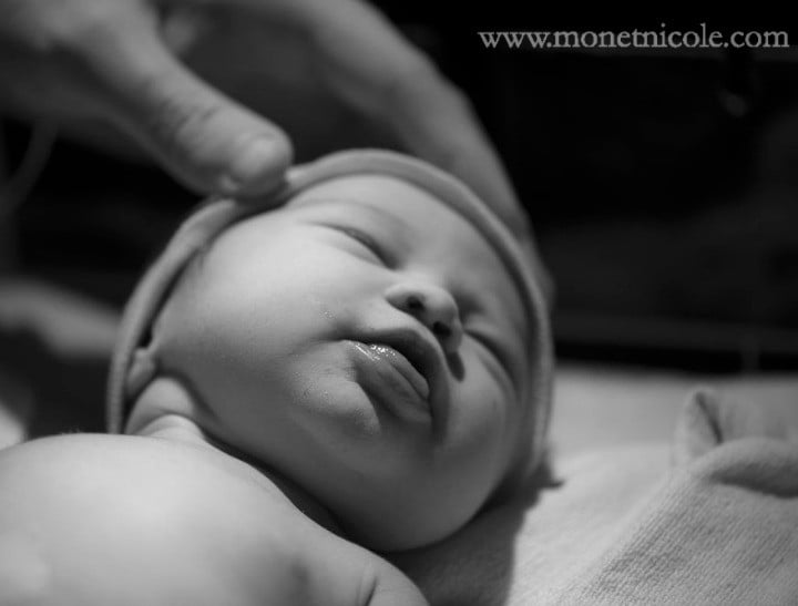 16 Moms Opened Up About What C-Section Births Are Really Like And They Are  True Superwomen