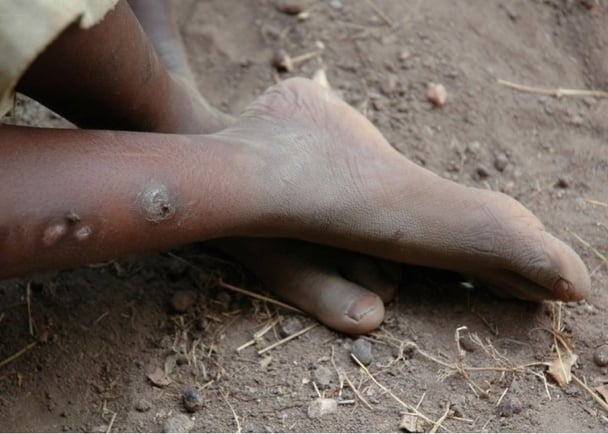 the shoe that grows