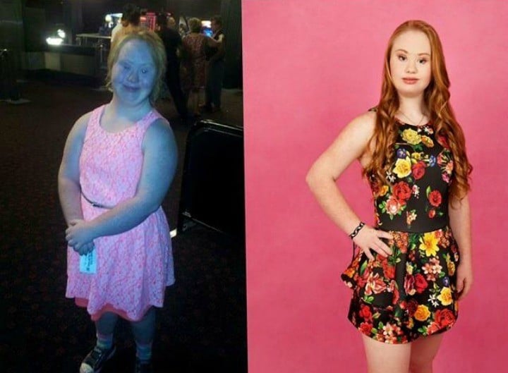 down syndrome model