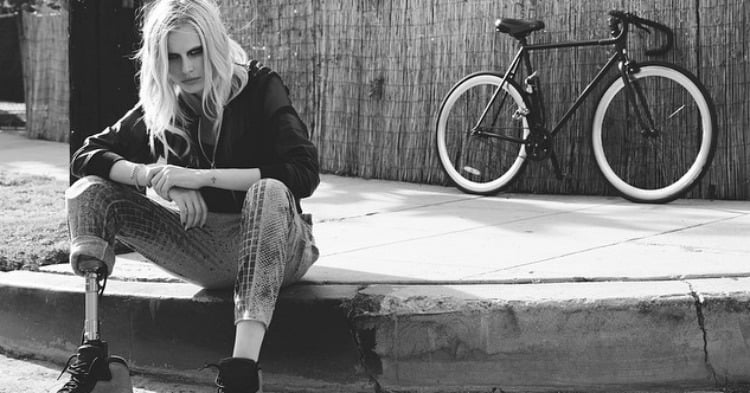 This Model Lost Her Leg To Toxic Shock Syndrome. Now She Has A Warning ...