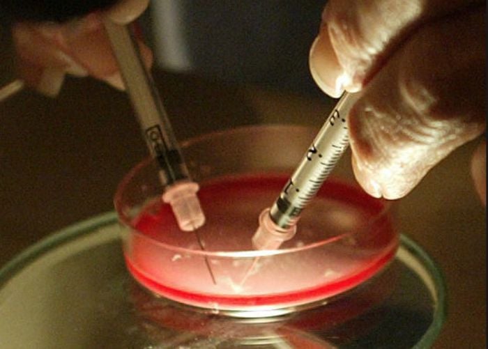 gender-selection-with-ivf-treatment-details-cost