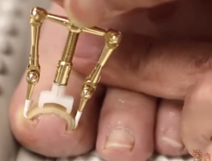 toenail-feature