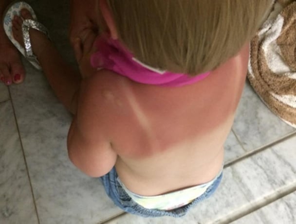 sunscreen 4