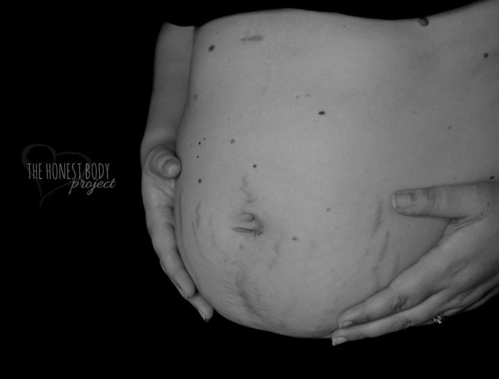 Real pregnancy photos changing how women feel.