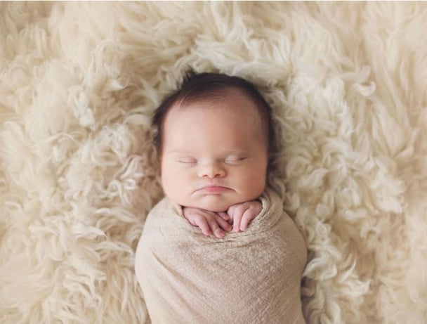 baby with a brain tumour
