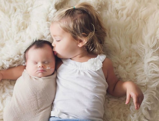 baby with a brain tumour