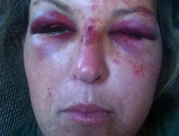 day care worker beaten