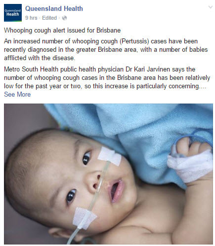 The most persuasive case for whooping cough vaccination.