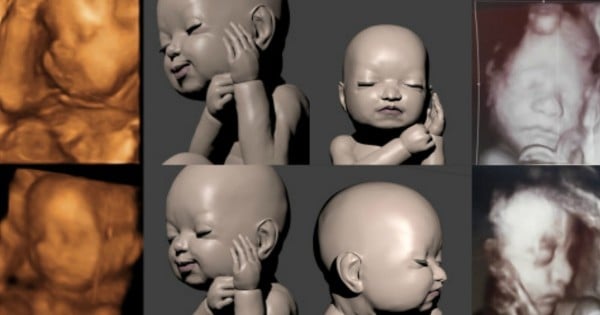 3D printed foetus