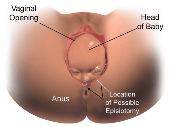 Vagina Of Pregnant 45