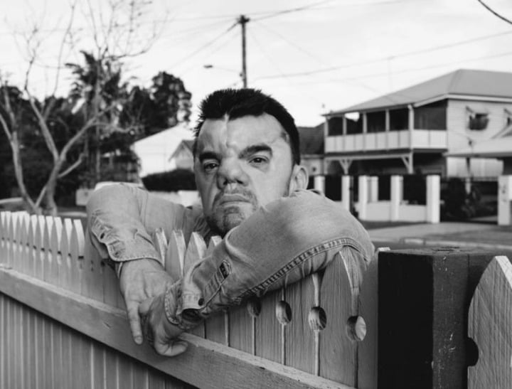 robert hoge