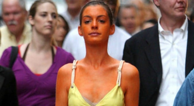 How To Fix Patchy Tan And 3 Other Common Fake Tan Problems How To Fix Patchy Tan And 3 Other Common Fake Tan Problems