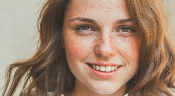 Freckles Are In Should You Fake Them 0695