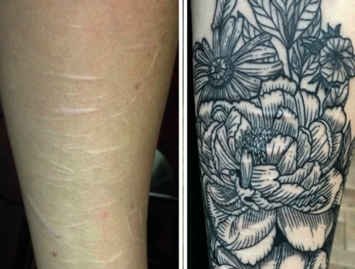 Selfharm scars are being covered by a Brisbane tattoo artist.