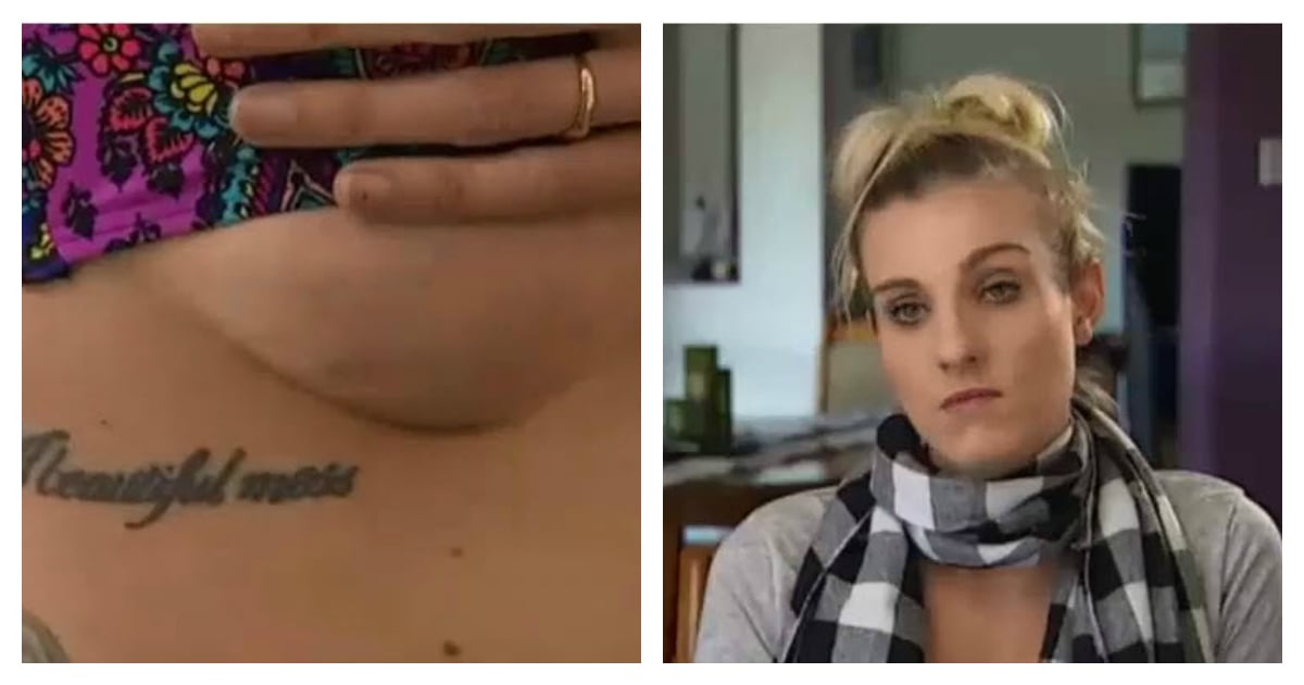 Botched breast implants ruined my life', says NSW mum.