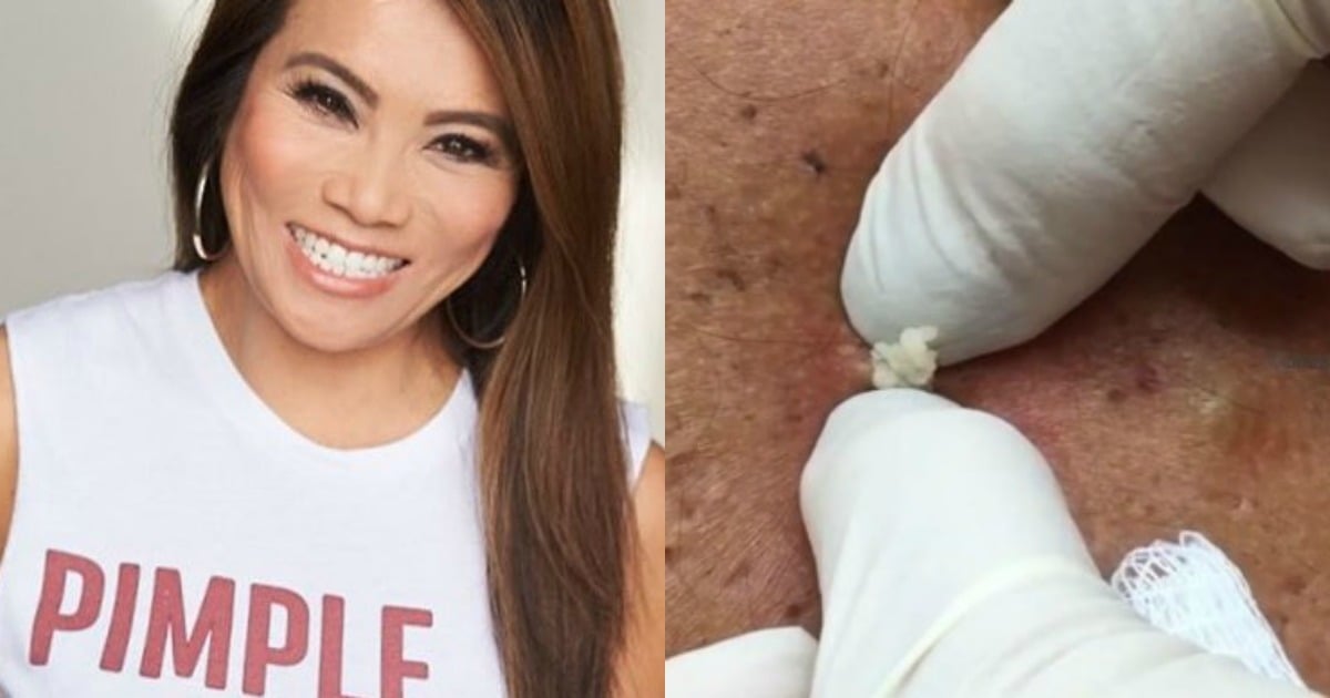 Behold Dr Pimple Popper skincare is now a thing.