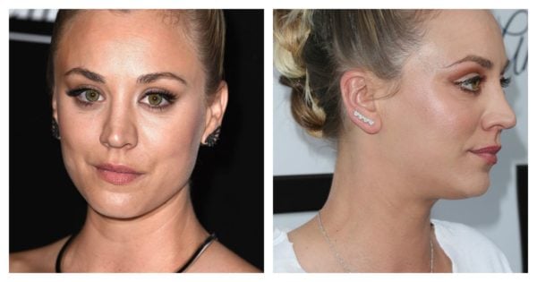 Kaley Cuoco Plastic Surgery Is The Best Thing I Ve Ever Done