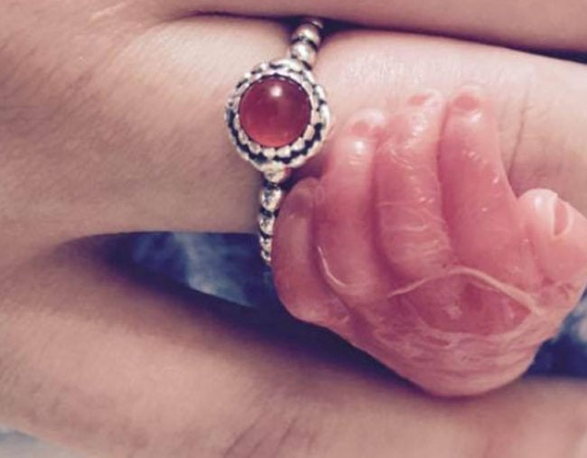 emma flynn stillbirth hand