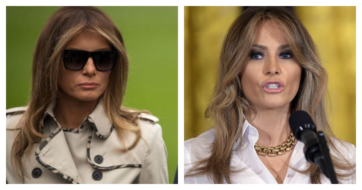 Melania Trump Conspiracy Theory: Apparently, They're Using A Body Double.