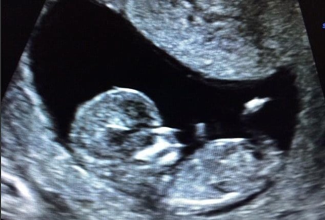 Wippa's wife pregnant