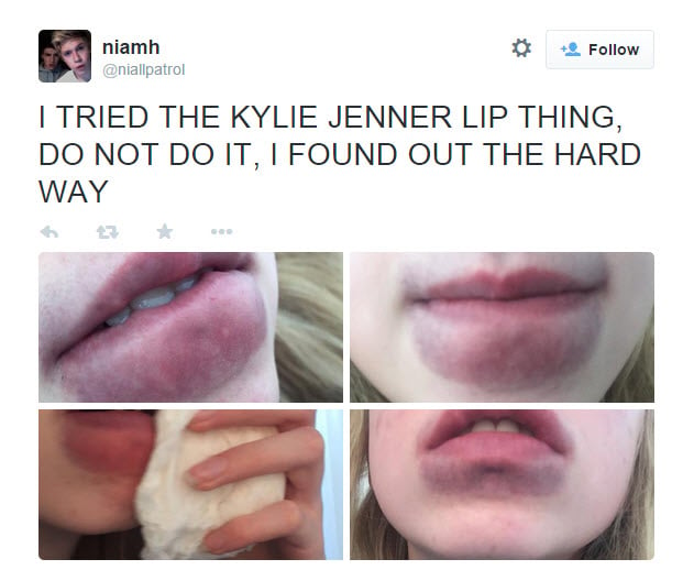 Kylie Jenner Lip Challenge With Gatorade Bottle Famous Person