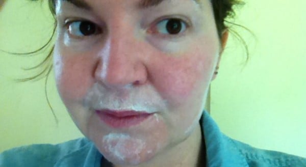 Dentist numbing gel is the secret to painless hair removal