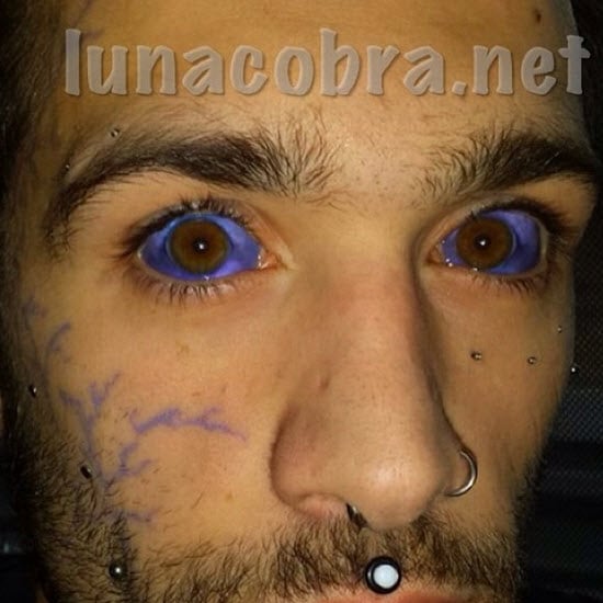 Woman Who Tattooed Eyeballs Purple And Blue Losing Eyesight