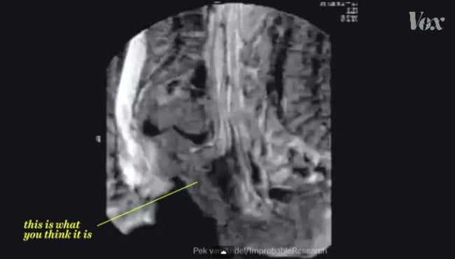 Yes You Want To Know What Sex In An MRI Scanner Looks Like