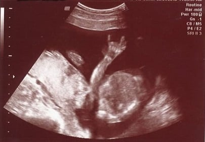 bad ultrasound photos these parents wish they'd never seen