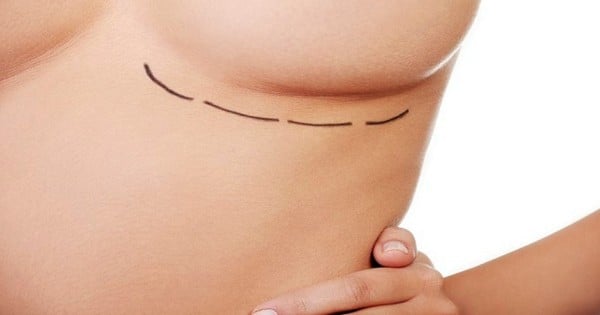 two breast reductions regrets
