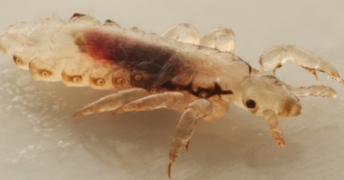 Does dog flea and tick 2025 shampoo kill human head lice