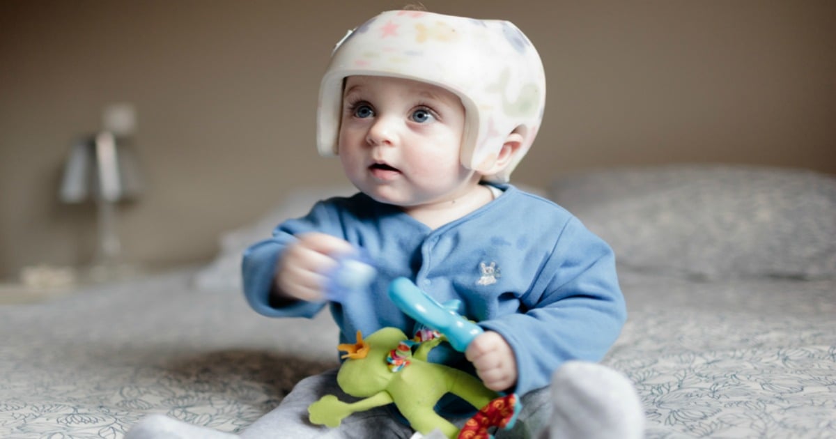 Parents ignoring SIDS risk to avoid flat head syndrome.