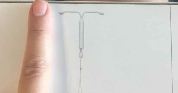 iud insertion what its really like getting a mirena put in mirena size