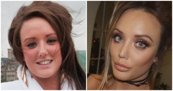 Charlotte Crosby plastic surgery is damaging for all involved.