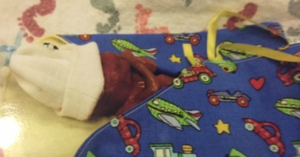 stillbirth photos