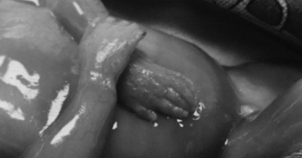 stillbirth photos
