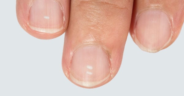 how-to-grow-nails-at-home