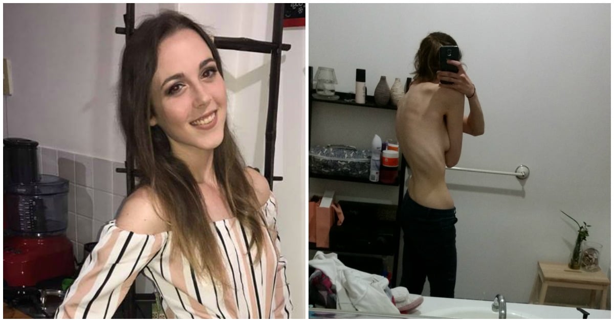 eating disorders