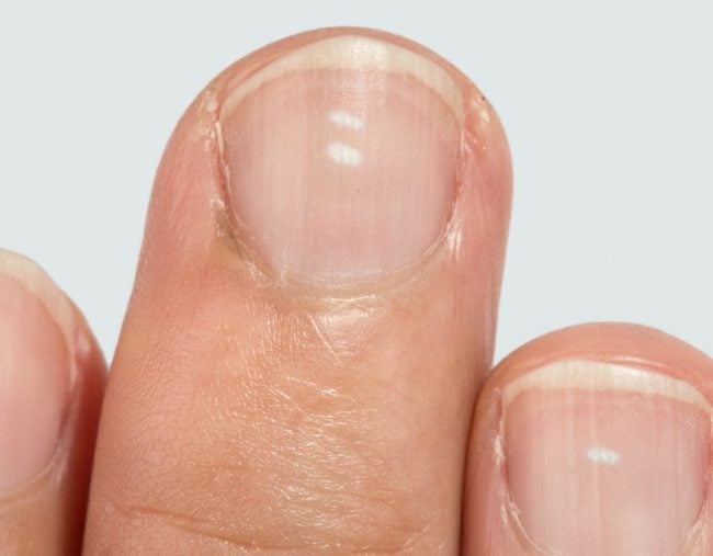 Five things your fingernails can say about your health.