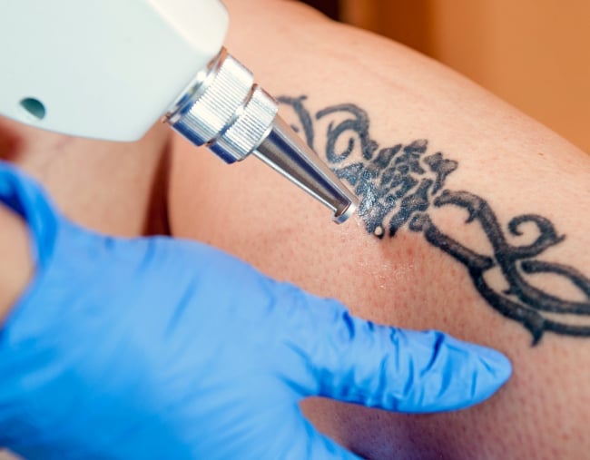 CASCADE MEDICAL SPA & TATTOO REMOVAL CENTER - 102 Photos & 50 Reviews -  1292 SE Holgate Blvd, Portland, Oregon - Tattoo Removal - Phone Number -  Services - Yelp