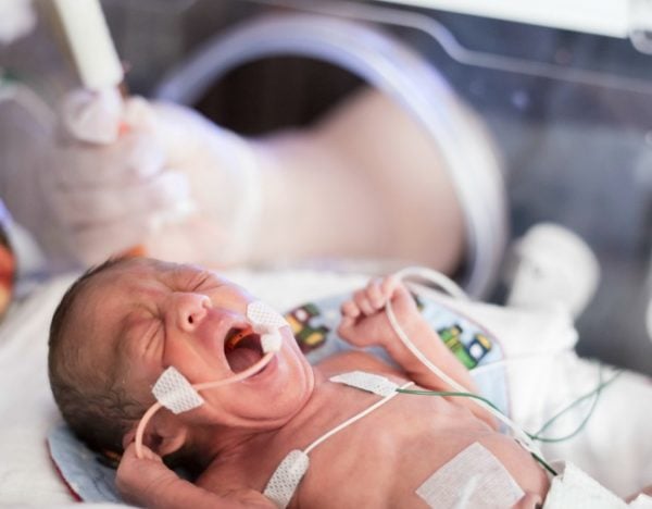 premature-baby